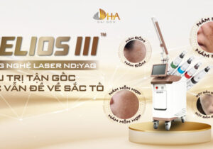 Máy điều trị nám